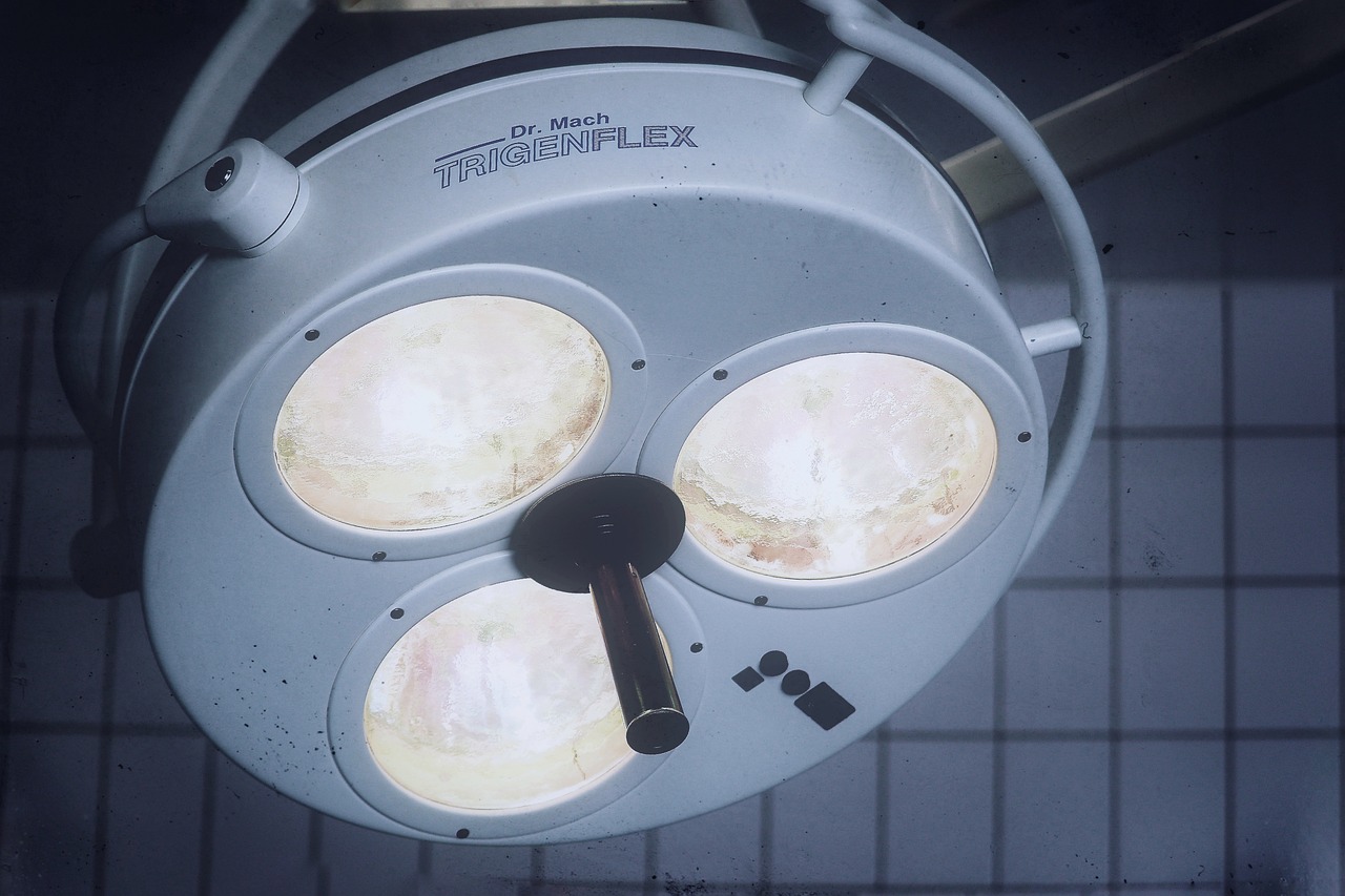 如何利用技术支持手段来寻找游戏的漏洞？